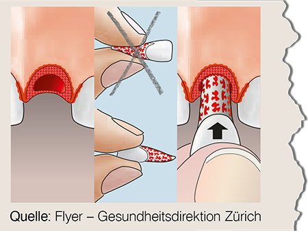 Quelle: Flyer – Gesundheitsdirektion Zürich Quelle: Flyer – Gesundheitsdirektion Zürich